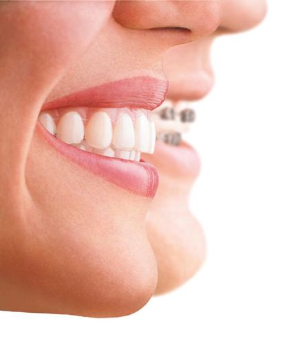 ORTODONCIA SEVILLA · Ortodoncia niños y adultos · Implantes · Estética Dental