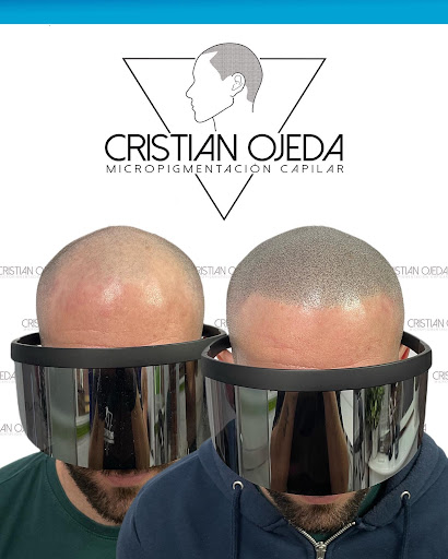 Cristian Ojeda Micropigmentación Capilar