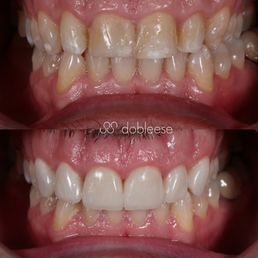 Dobleese Clínica Dental en Sevilla Implantes Dentales, Carillas Dentales, Periodoncia y Estética Dental
