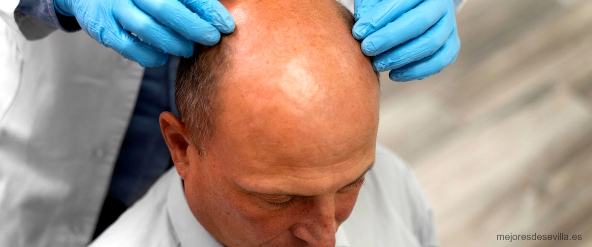 ¿Cuánto cuesta un trasplante de cabello en la mejor clínica capilar de Sevilla?